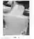 Fig. 04 - Vascular casted prostheses and methods of forming same for treating biological tissue