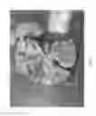 Fig. 06 - Vascular casted prostheses and methods of forming same for treating biological tissue