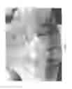 Fig. 10 - Vascular casted prostheses and methods of forming same for treating biological tissue