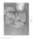 Fig. 11 - Vascular casted prostheses and methods of forming same for treating biological tissue