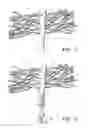 Fig. 02 - Vascular casted prostheses and methods of forming same for treating biological tissue