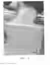 Fig. 04 - Vascular casted prostheses and methods of forming same for treating biological tissue