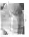 Fig. 05 - Vascular casted prostheses and methods of forming same for treating biological tissue