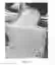 Fig. 04 - Vascular casted prostheses and methods of forming same for treating biological tissue