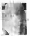 Fig. 05 - Vascular casted prostheses and methods of forming same for treating biological tissue