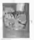 Fig. 06 - Vascular casted prostheses and methods of forming same for treating biological tissue