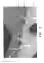 Fig. 13 - Vascular casted prostheses and methods of forming same for treating biological tissue