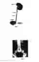 Fig. 02 - Delivery method for biodegradable stents