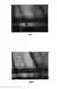 Fig. 04 - Delivery method for biodegradable stents