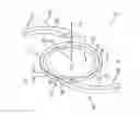 Fig. 01 - Foldable intraocular lens and method of making