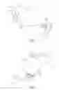 Fig. 04 - Foldable intraocular lens and method of making