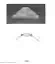 Fig. 12 - Accommodative intraocular lens and method of improving accommodation