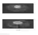 Fig. 14 - Accommodative intraocular lens and method of improving accommodation