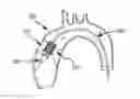 Fig. 01 - Everting transcatheter valve and methods