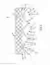 Fig. 04 - Everting transcatheter valve and methods