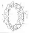 Fig. 13 - Replacement cardiac valves and methods of use and manufacture