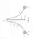 Fig. 15 - Replacement cardiac valves and methods of use and manufacture