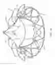 Fig. 17 - Replacement cardiac valves and methods of use and manufacture