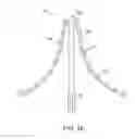 Fig. 19 - Replacement cardiac valves and methods of use and manufacture
