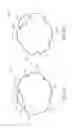 Fig. 08 - Replacement cardiac valves and methods of use and manufacture