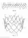 Fig. 04 - Replacement cardiac valves and methods of use and manufacture