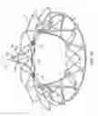 Fig. 16 - Replacement cardiac valves and methods of use and manufacture