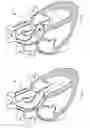 Fig. 02 - Device and methods for self-centering a guide catheter