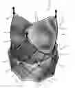Fig. 01 - Prosthetic heart valve system and delivery system therefor