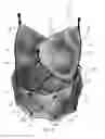 Fig. 04 - Prosthetic heart valve system and delivery system therefor