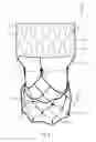 Fig. 06 - Prosthetic heart valve system and delivery system therefor