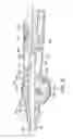 Fig. 13 - Integrated heart valve delivery system