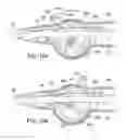 Fig. 15 - Integrated heart valve delivery system