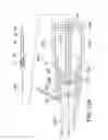 Fig. 21 - Integrated heart valve delivery system