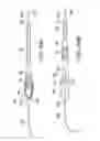 Fig. 23 - Integrated heart valve delivery system