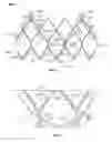 Fig. 04 - Valve cuff support