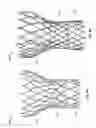 Fig. 05 - Valve cuff support