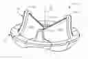 Fig. 01 - Prosthetic mitral valve