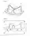 Fig. 02 - Prosthetic mitral valve
