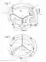 Fig. 03 - Prosthetic mitral valve