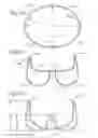 Fig. 04 - Prosthetic mitral valve
