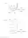 Fig. 03 - Artificial knee joint implant