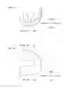 Fig. 05 - Artificial knee joint implant