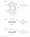 Fig. 06 - Artificial knee joint implant