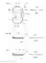 Fig. 07 - Artificial knee joint implant