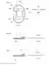 Fig. 08 - Artificial knee joint implant