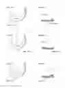 Fig. 09 - Artificial knee joint implant