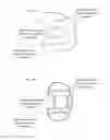 Fig. 11 - Artificial knee joint implant