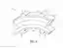 Fig. 04 - Attachments for orthopedic implants
