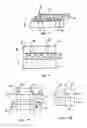 Fig. 04 - Multi-piece intervertebral implants