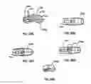Fig. 19 - Multi-piece intervertebral implants